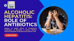 Image result for Maddrey Discriminant Function