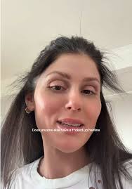 BEAT. I’m ready to PRP my head #hairline #hairstruggles