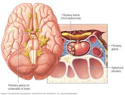 Pituitary Tumor Pituitary Gland Tumor Tumor Pituitary Gland