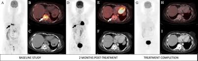 We did not find results for: Pet Ct Scan ä¸­æ Ct Scan Machine