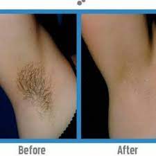 For the best technique and results, dermatologists recommend these tips. Hair Removal Cream Get Super Smooth Skin Beauty Remedies Hair Removal Cream Unwanted Hair Removal