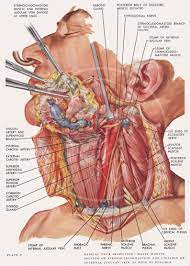 Plate 5 Radical Neck Dissection 10x14 Giclee Canvas Print Of Vintage Surgical Illustration Salud Medical Anatomy Medical Illustration Anatomy Of The Neck