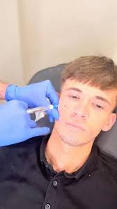 Bizarre anti-ageing trend sees men injecting salmon sperm into their faces 