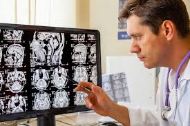 Neurologia este o ramură specială a medicinii care se ocupă cu diagnosticul și tratamentul bolilor organice care afectează sistemul nervos central, periferic si vegetativ. Boli Ale Sistemului Nervos