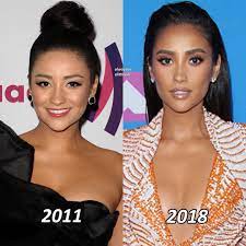 Pin By Papitauwu On Shay Mitchell Shay Mitchell Celebs Plastic Surgery Photos