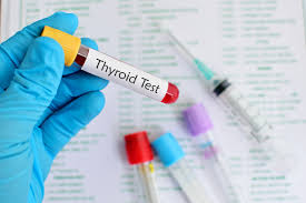 Image result for Thyroid Function Test