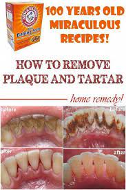 Home Remedies To Remove Plaque And Tartar Tartar Can Manifest In Different Ways Bad Breath Chronical Swollen Gums Teeth Health Health Remedies Dental Health