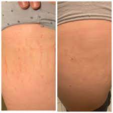 Pin On Professional Beauty