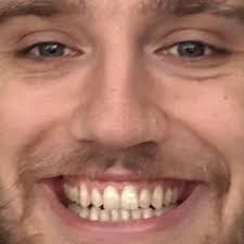 James Umber🐞 (@JAMESUMBER)