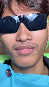 #chantlaclinicdental #foryoupage #viral #khmerdentist #foryou #dentist #fy  #fyp