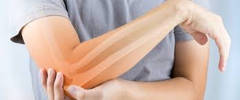 Mucize Sonuclara Inanamayacaksiniz Romatizma Agrisi Nasil Gecer Cam Termal Otel