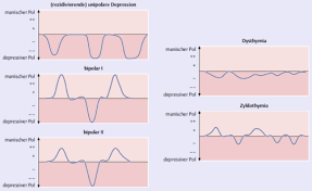 2gm03 Psychopathologie Affektive Storungen Flashcards Quizlet