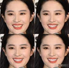 Hơn nữa, trong vài khoảnh khắc, cô cười còn bị hở lợi kém duyên dáng. Ä'iá»ƒm Xáº¥u Cháº¿t NgÆ°á»i Cá»§a Tháº§n Tien Tá»· Tá»· LÆ°u Diá»‡c Phi Lam Sao Ä'á»ƒ Cáº£i Thiá»‡n