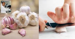 Selain untuk campuran olahan makanan, minyak bawang putih juga bisa anda gunakan sebagai obat penghilang kudis. Doktor Ini Pesan Ketuk Dulu Bawang Putih Tunggu 10 Minit Sebelum Makan Baru Dapat Khasiat Antikanser Yang Kuat Vanilla Kismis