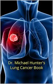 A cancer may also cause symptoms like fever, extreme tiredness (fatigue), or weight loss. Dr Michael Hunter S Lung Cancer Book What You Need To Know By Michael Hunter