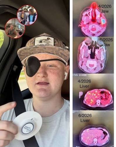 => Details: https://us.gymroomathome.com/60096/ 💔➡️💙 FROM STRUGGLE TO  HOPE, Will Roberts, 17, continues his fight against aggressive bone cancer,  facing daily treatments and ongoing medical ...