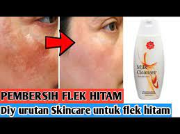Dec 18, 2020 · nah, sekarang kamu bisa mengetahui penyebab munculnya bintik hitam ini langsung dari skin care experts. Wajib Tonton Diy Urutan Skincare Untuk Flek Hitam Dan Pembersih Wajah Youtube