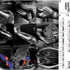 E. Cazorla's research works