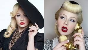 Derita sakit Crohn, Cassidy alergi terhadap banyak makanan