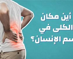 صورة الكلى (جسم الإنسان)