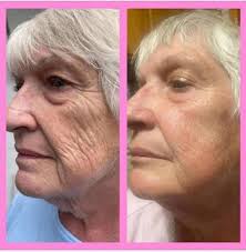 All natural anti wrinkle facial moisturizer for sale