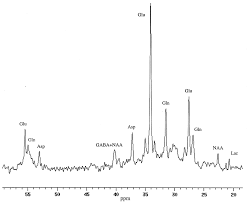 So how does france's new president françois hollande compare to past leaders? Determination Of The Rate Of The Glutamate Glutamine Cycle In The Human Brain By In Vivo 13c Nmr Pnas