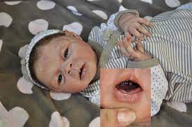Silicone Baby For Sale For Sale Off 78