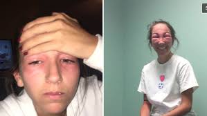 This Woman Got Poison Ivy in Her Eyes and the Photos Are Going Viral