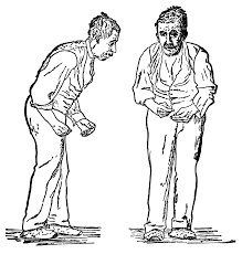Parkinson S Disease Wikipedia