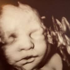 Natassia (Bella) Stevenson and K-Shaun Weaver's Baby Registry at Babylist