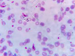 Parasite in cyte