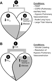 Image result for Afterload
