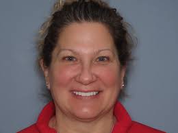 I'd Like to Get Some Veneers”