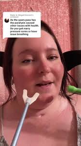 Replying to @Abigail Bronson #fyp #foryou #foryoupage #fypシ #everyonesfyp  #kidneystones #uti #virał #viraltiktok #quadriplegic #paralyzed  #ibrokemyneck #disabledtok #disabilitytok #wheelchair ...