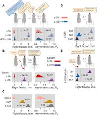 Left Right Side Specific Endocrine Signaling Complements Neural Pathways To Mediate Acute Asymmetric Effects Of Brain Injury Elife