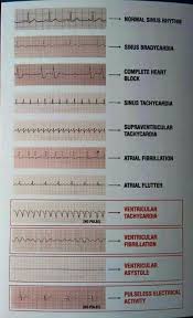 Pin On Nursing