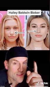 Justin and Hailey sue the plastic surgeon who spoke about 'the model's  cosmetic interventions'