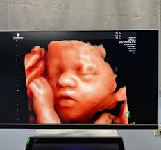 The Gauteng Department of Health is hosting the 12th Annual Midwifery  Obstetric Neonatal and Child Health (MONEC) Conference under the theme:  “Nurses and Midwives: Critical in Every Crisis” which calls