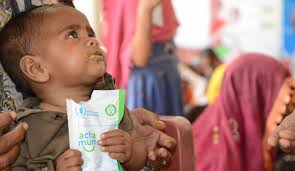 The Wasting and Stunting Technical Interest Group: Generating Evidence to  Challenge the Divide in Nutrition