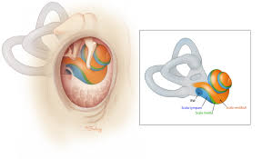 Image result for Cochlear Implant