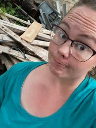 Prayer Request for Injury Recovery