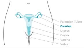 Its vague, insidious onset means that it tends not to present until it is too late, and there is currently ovarian cancer tends to present with a pelvic mass, so i've included a differential diagnosis for this. Ovarian Cancer Wikipedia