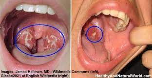 Pin On Herbal Remedies