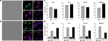 We can not only store your cord blood! Umbilical Cord Blood Derived Microglia Like Cells To Model Covid 19 Exposure Translational Psychiatry