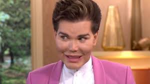 He said he's now dealing with persistent health issues related to the surgeries, including his nose sinking from infections. Human Ken Doll Rodrigo Alves Dramatic Transformation From Dad Bod To Plastic Fantastic