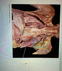 Solved Pal Cadaver Cardiovascular System Blood Vessels Chegg Com