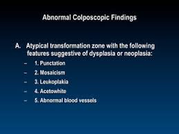 Image result for Colposcopy Findings