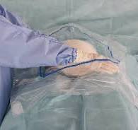 Medical Drapes from Winner Medical-Winner Medical