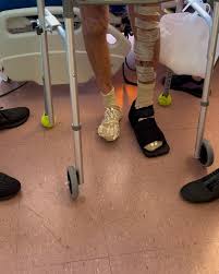 Today was a fabulous day!! , First steps in 45 days, a new hairstyle and a  ride outside his room!, Go Bob!!