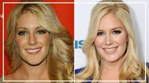 Montag's surgeries may have shocked fans, but plastic surgery and other cosmetic procedures are common and on the rise. Heidi Montag Amazing Transformation Before And After Plastic Surgery Youtube